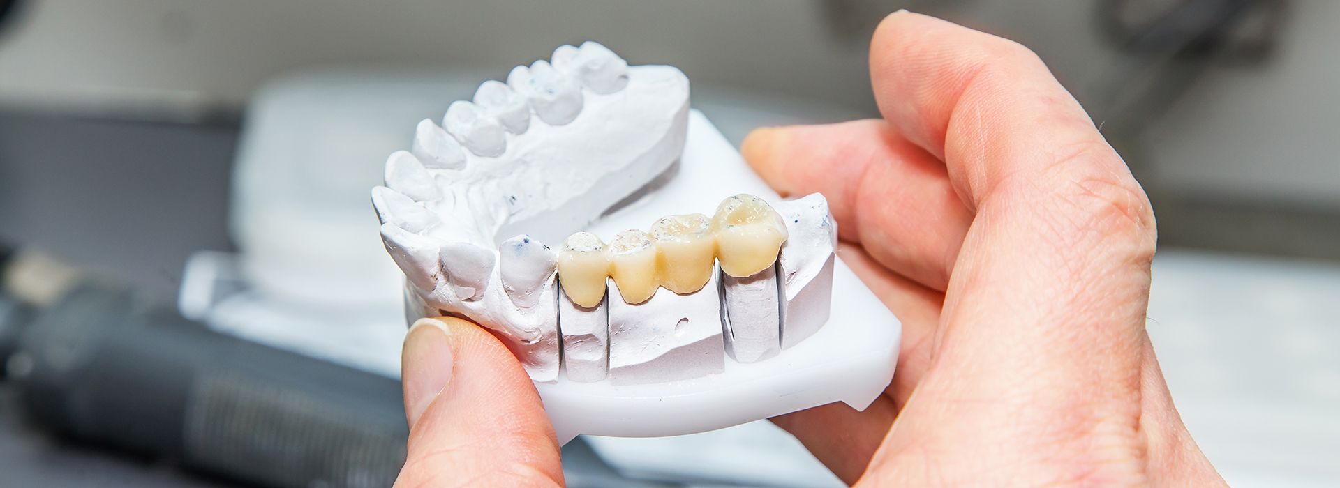 A person s hand holding a white 3D printed dental model, showcasing teeth and gum details.