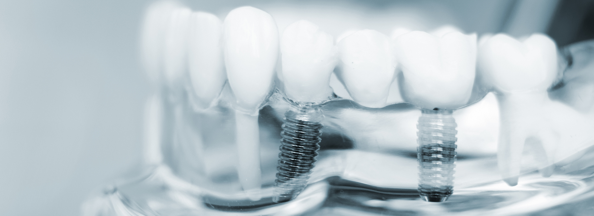 The image shows a close-up of multiple teeth with visible braces, set against a blurred background that appears to be a clear, transparent material.