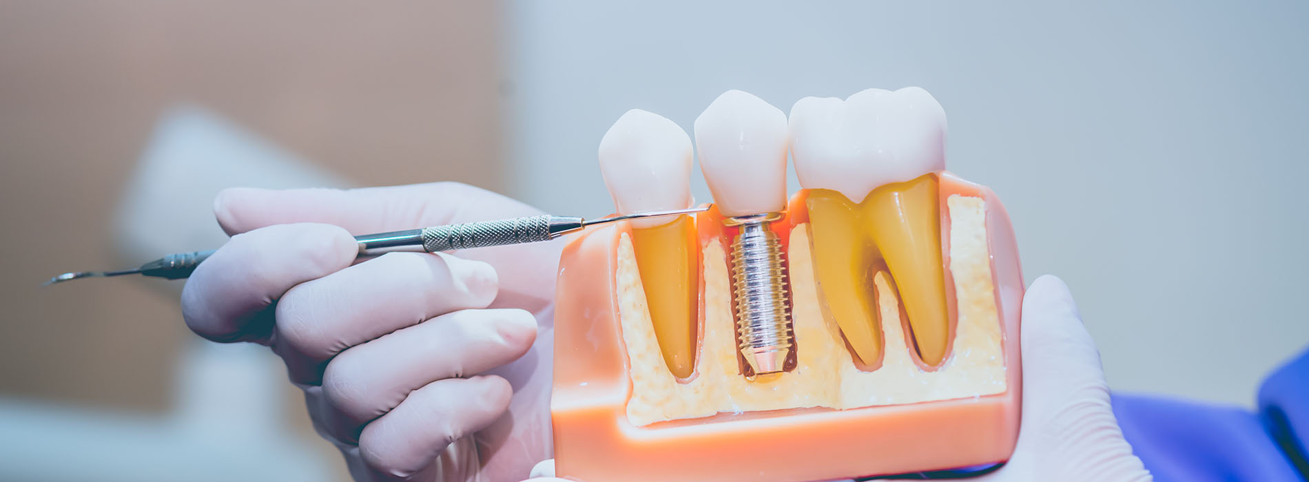 The image shows a close-up of a dental tool with a tooth in a vice, being worked on by a person s hands, which are holding the tool.