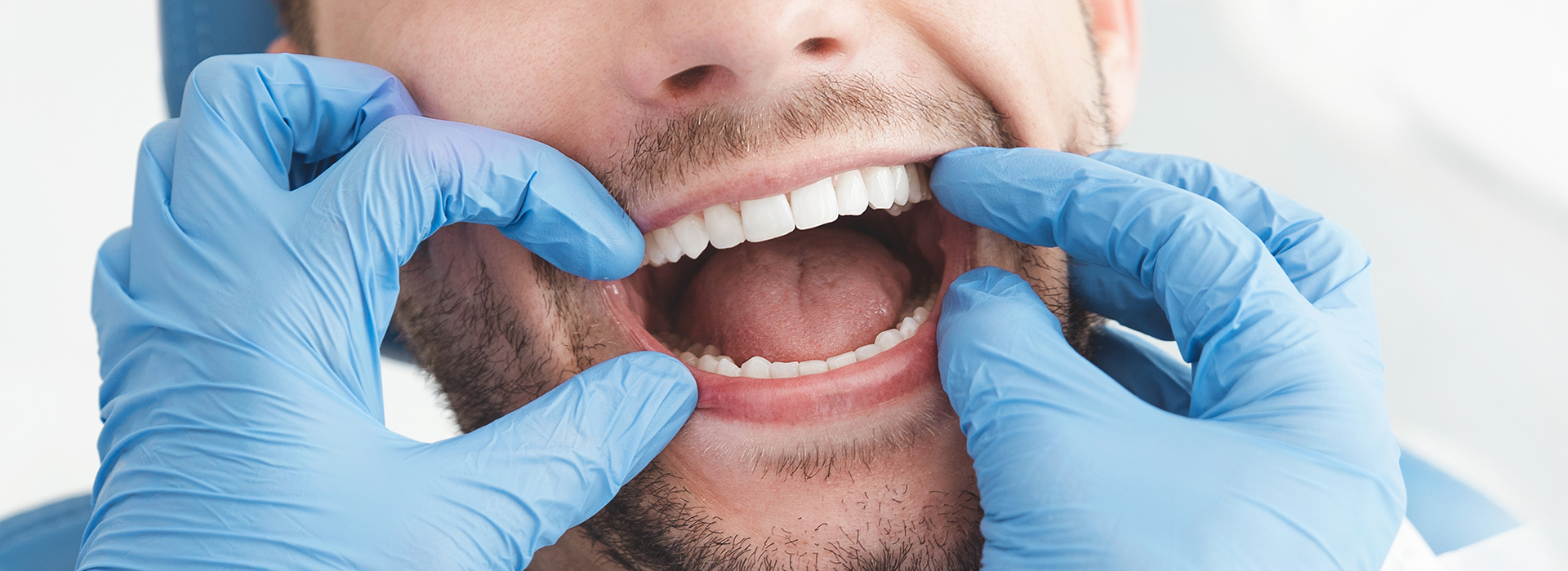 The image is a photograph of a person with their mouth open, wearing blue gloves and a white lab coat, which suggests they are a dental professional or a medical professional.